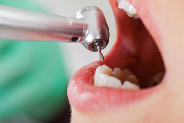 Best Emergency Treatment for Toothache in Alvin, TX